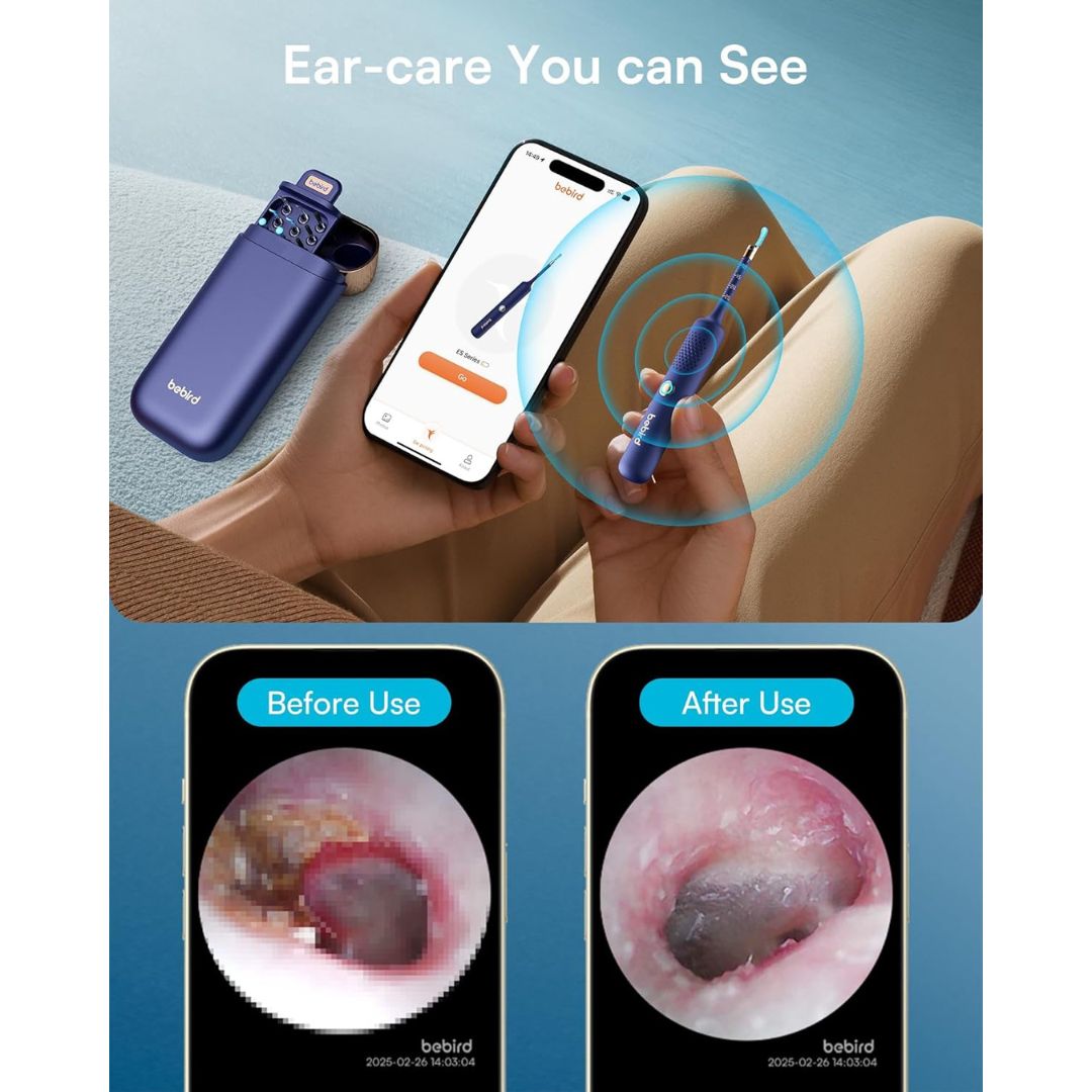 Bebird Smart Visual Ear Cleaner – Earsight Plus (White)
