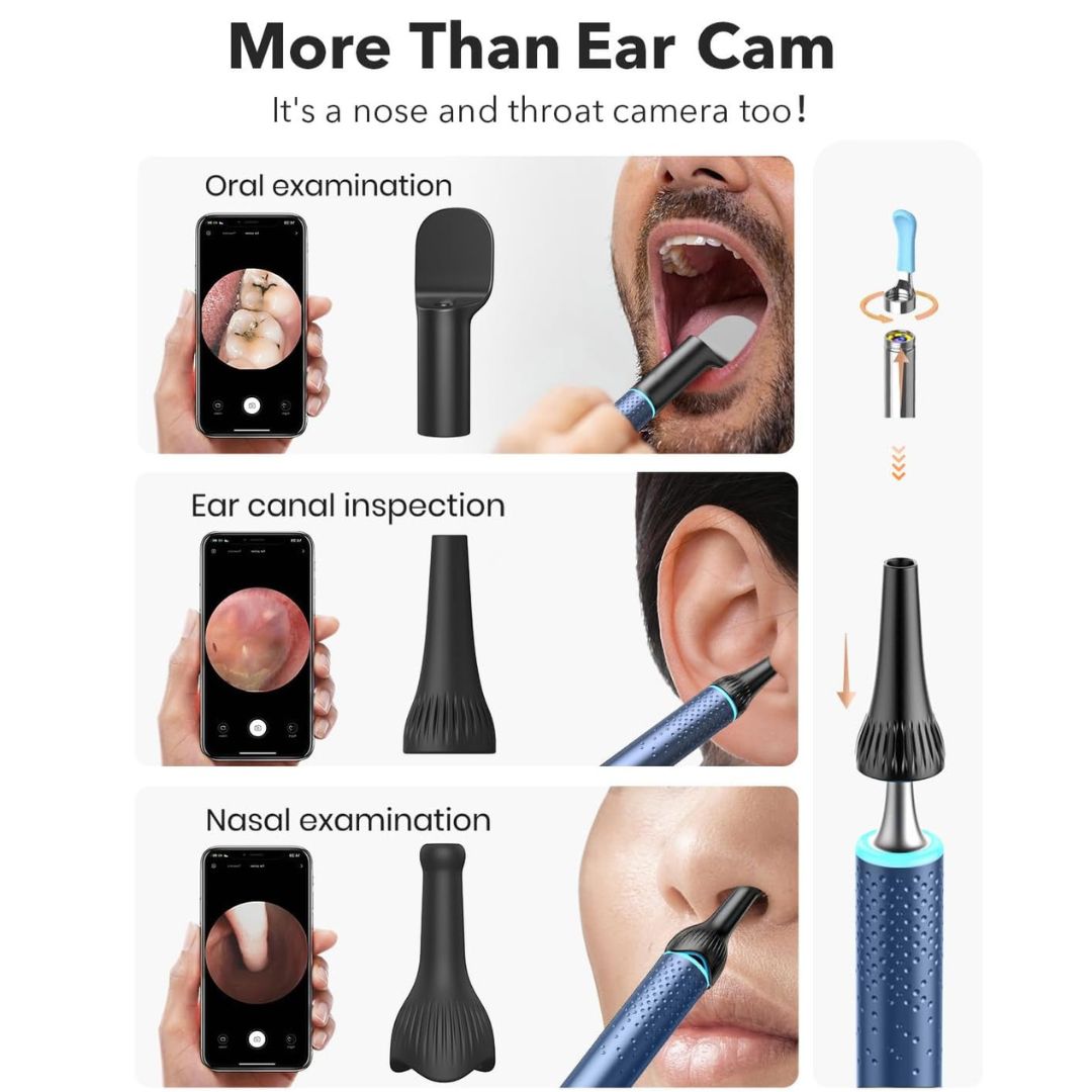 Bebird Smart Visual Ear Cleaner – M9S