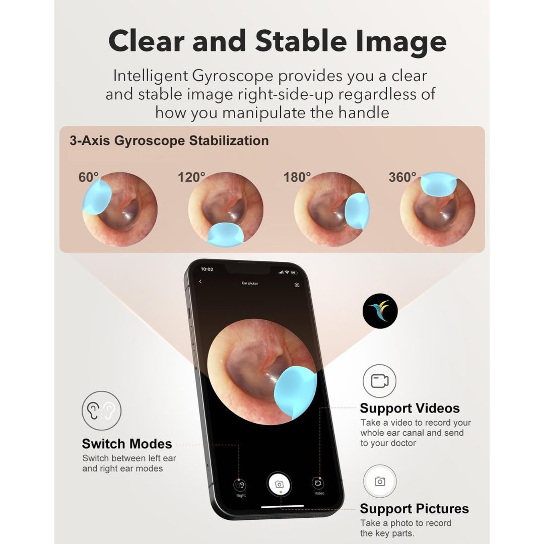 Bebird Smart Visual Ear Cleaner – Earsight Plus (Dark Blue)